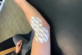 Iontophoresis Vargo Physical Therapy